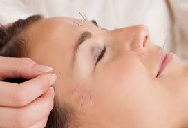 facial acupuncture facial acupuncture