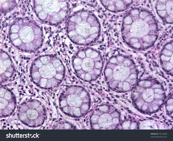glandular shutterstock.jpg600x600