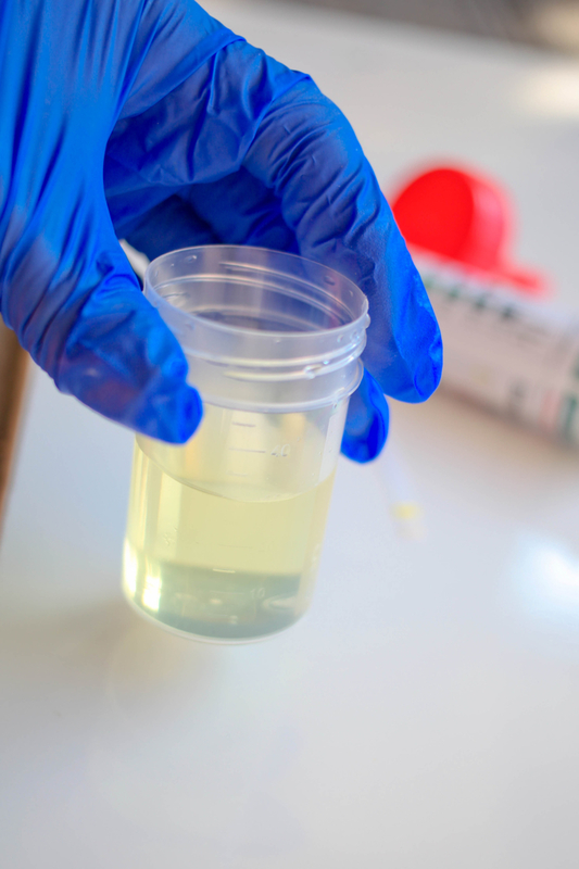 urine article