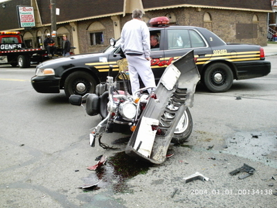 Motorcycle Accident Photos (Exhibits)
